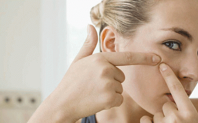 4 เหตุก่อสิวของคนติดโซเชี่ยล คุณมีสิทธิ์เป็นได้ไหม?